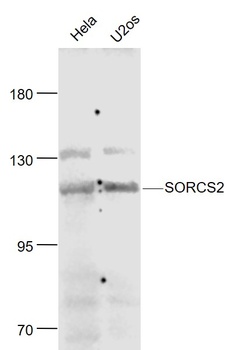SORCS2 antibody