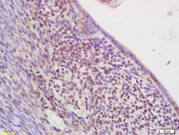 SOX17 Rabbit Polyclonal Antibody