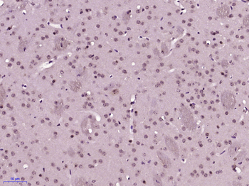 SOX21 Rabbit Polyclonal Antibody