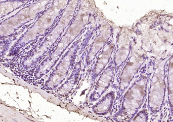 SOX7 Rabbit Polyclonal Antibody