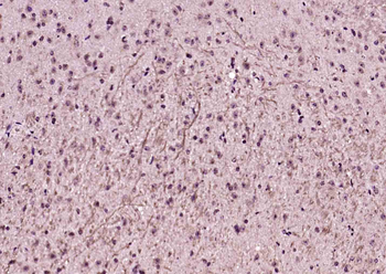 SRPX2 Rabbit Polyclonal Antibody