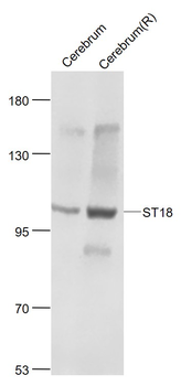 ST18 Rabbit Polyclonal Antibody