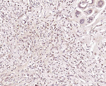 STAT4 Rabbit Polyclonal Antibody