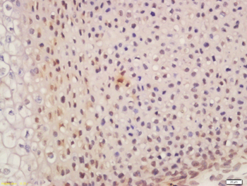 SUFU Rabbit Polyclonal Antibody