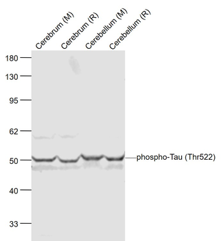 Phospho-Tau (Thr522) Rabbit Polyclonal Antibody