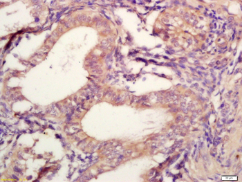 TIMP-2 Rabbit Polyclonal Antibody