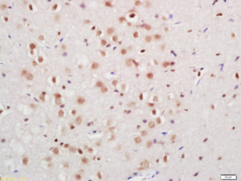 TNIP1 Rabbit Polyclonal Antibody