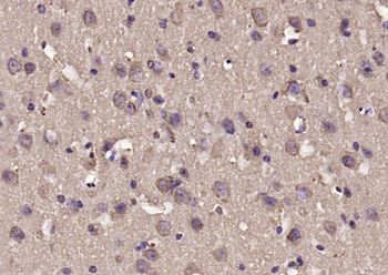 TPPP Rabbit Polyclonal Antibody