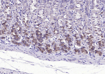 TRA1 variant Rabbit Polyclonal Antibody