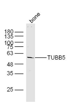 TUBB5 antibody
