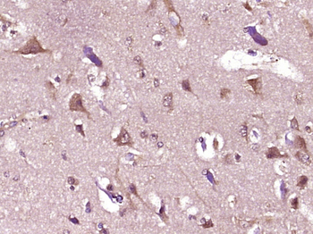 UBXD2 Rabbit Polyclonal Antibody