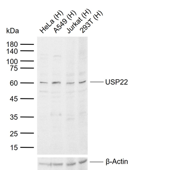 USP22 Rabbit Polyclonal Antibody