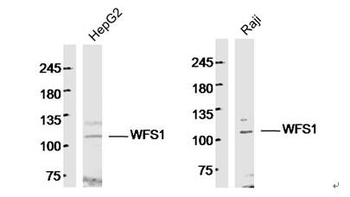 WFS1 Rabbit Polyclonal Antibody