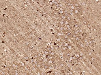 ZAK Rabbit Polyclonal Antibody