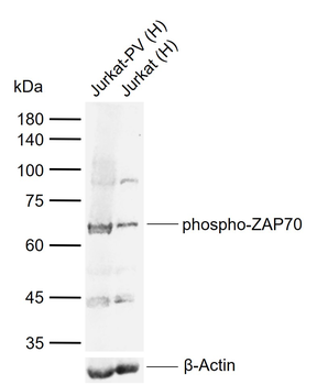 Phospho-ZAP70 (Tyr292) Rabbit Polyclonal Antibody