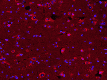 TUBB3 (Neuronal Marker) Rabbit Polyclonal Antibody (BF594)