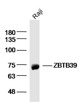 ZBTB39 Rabbit Polyclonal Antibody