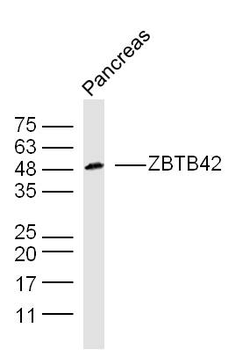 ZBTB42 Rabbit Polyclonal Antibody