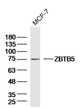 ZBTB5 Rabbit Polyclonal Antibody