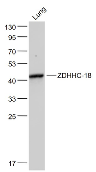 ZDHHC-18 Rabbit Polyclonal Antibody