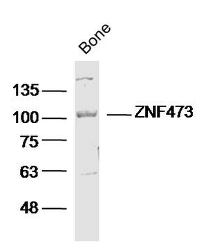 ZFP100 / ZNF473 Rabbit Polyclonal Antibody