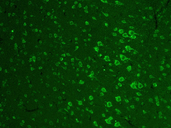 Zic1 Rabbit Polyclonal Antibody