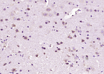 Zic2 Rabbit Polyclonal Antibody