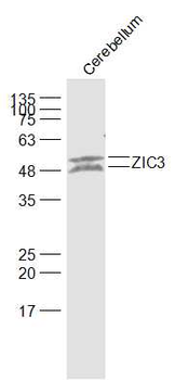 ZIC3 Rabbit Polyclonal Antibody