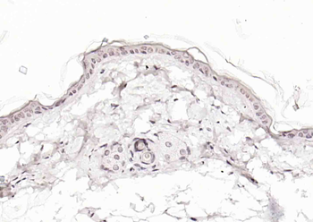 ZIC5 Rabbit Polyclonal Antibody