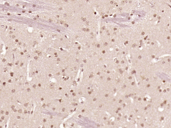 ZNF312 Rabbit Polyclonal Antibody