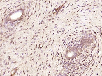 ZNF318 Rabbit Polyclonal Antibody