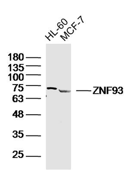 ZNF93 Rabbit Polyclonal Antibody