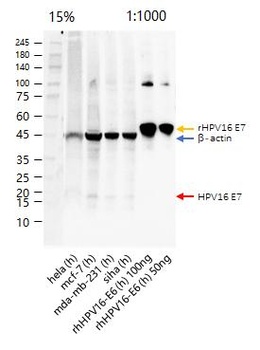 Hpv16 E7 antibody