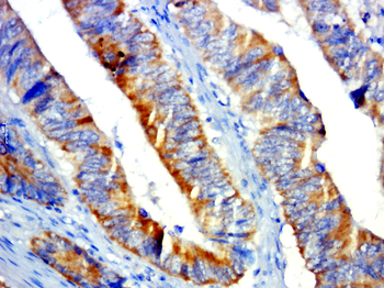 GPR31 Rabbit Polyclonal Antibody