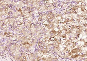 CED6 Rabbit Polyclonal Antibody