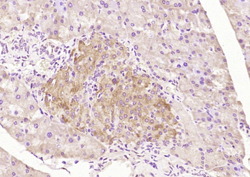 CED6 Rabbit Polyclonal Antibody