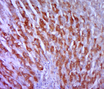 ALDH3A1 Rabbit Polyclonal Antibody