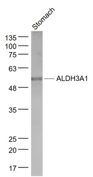 ALDH3A1 Rabbit Polyclonal Antibody