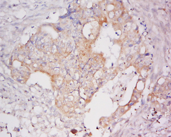CYP2S1 Rabbit Polyclonal Antibody