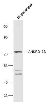 ANKRD13B Rabbit Polyclonal Antibody