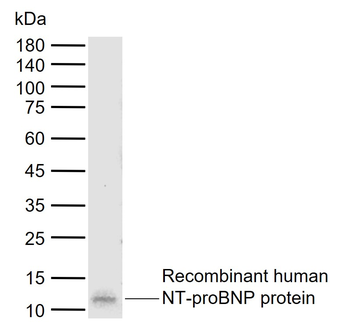 NT-proBNP/NPPB Mouse Monoclonal Antibody