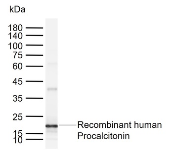 Procalcitonin (PCT) Antibody