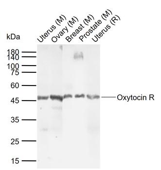 Oxytocin R Rabbit Polyclonal Antibody