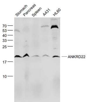 ANKRD22 Rabbit Polyclonal Antibody