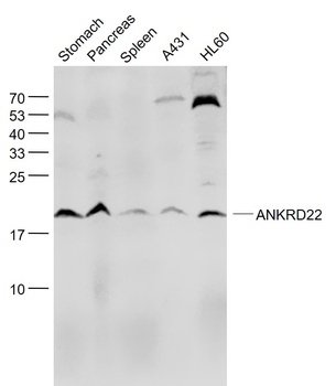 ANKRD22 antibody