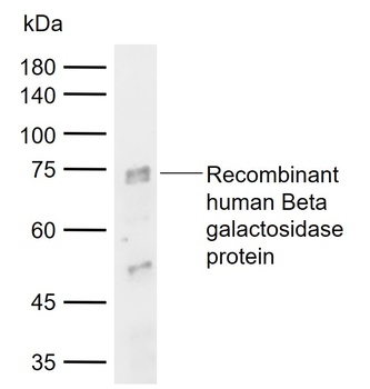 Beta galactosidase Antibody