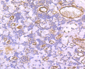 VWF Recombinant Rabbit Monoclonal Antibody