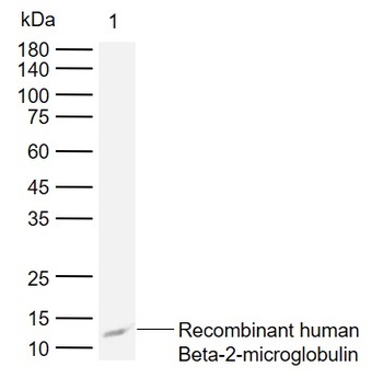 beta 2 Microglobulin Antibody
