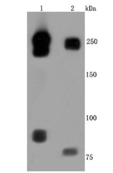 CD171/L1CAM Recombinant Rabbit Monoclonal Antibody