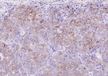 RBP4 Mouse Monoclonal Antibody